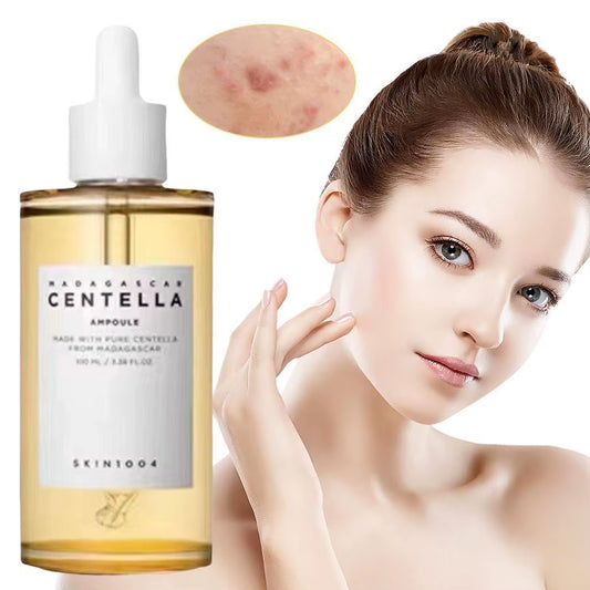 Skin1004 Centella Asiatica Serum Brightening Skin Tone Moisturizing Shrink Pores Anti-Ance Essence Korean Facial Skin Care